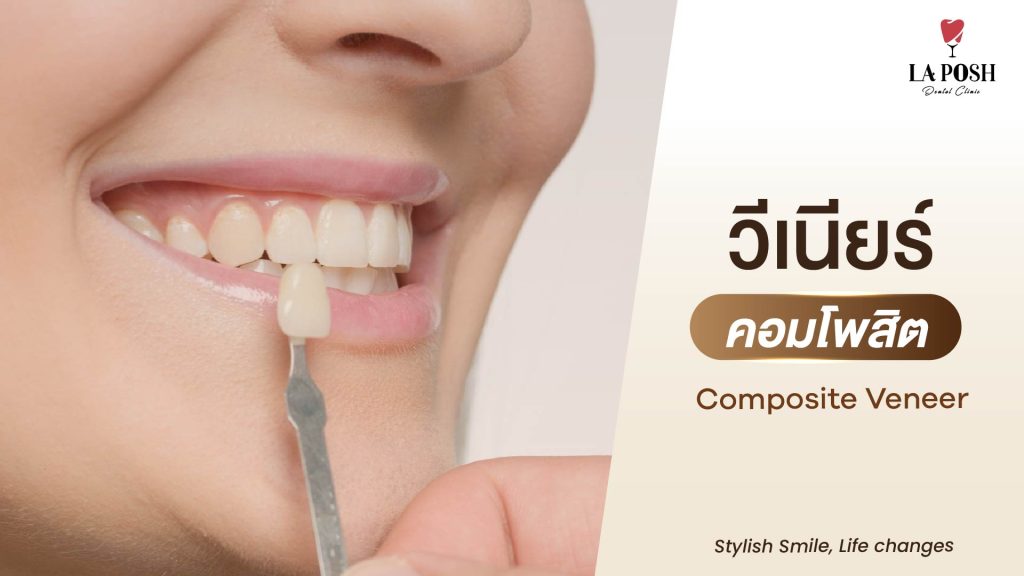 ทำวีเนียร์แบบคอมโพสิต (Composite Veneer)
