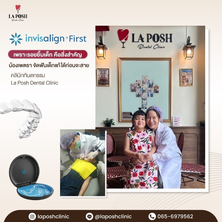 จัดฟันเด็ก 23 จัดฟันเด็ก ที่ La Posh Dental Clinic