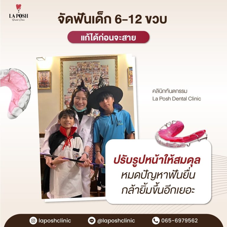 จัดฟันเด็ก 31 จัดฟันเด็ก ที่ La Posh Dental Clinic