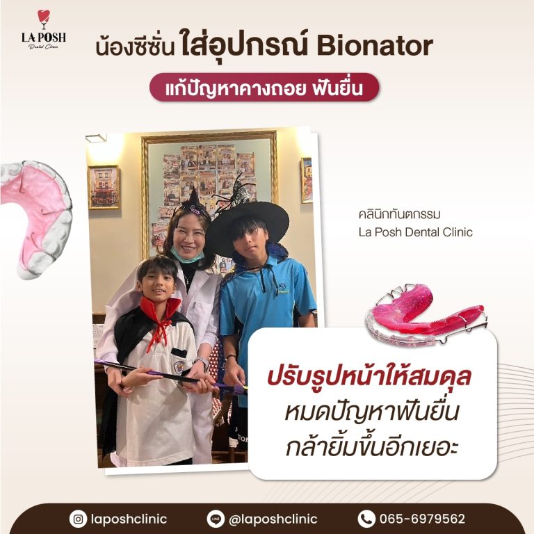 จัดฟันเด็ก 22 จัดฟันเด็ก ที่ La Posh Dental Clinic