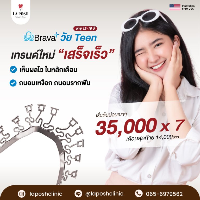จัดฟัน Brava 8 Brava-Promotion1