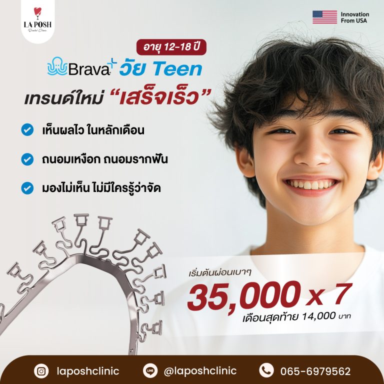 จัดฟัน Brava 10 โปรโมชั่นจัดฟัน Brava ที่ La Posh Dental Clinic