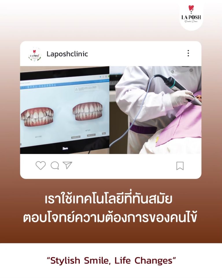 ฟอกสีฟัน 12 บรรยากาศและผลงานที่ La Posh Dental Clinic 4