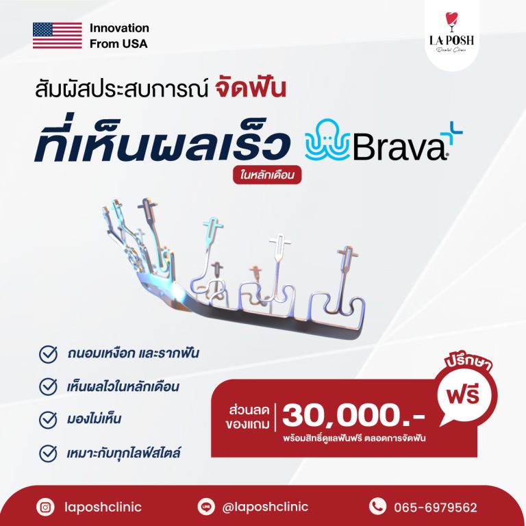 จัดฟัน Brava 7 โปรโมชั่นจัดฟัน Brava ที่ La Posh Dental Clinic
