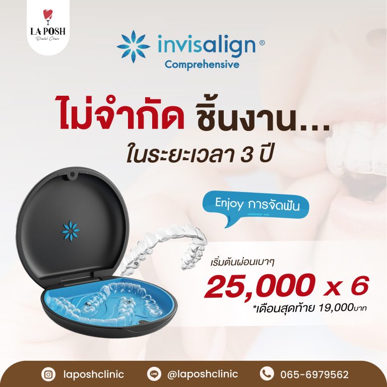 จัดฟันใส Invisalign คืออะไร เหมาะกับใคร ราคาเท่าไหร่? 4 Promotion-จัดฟันใส2