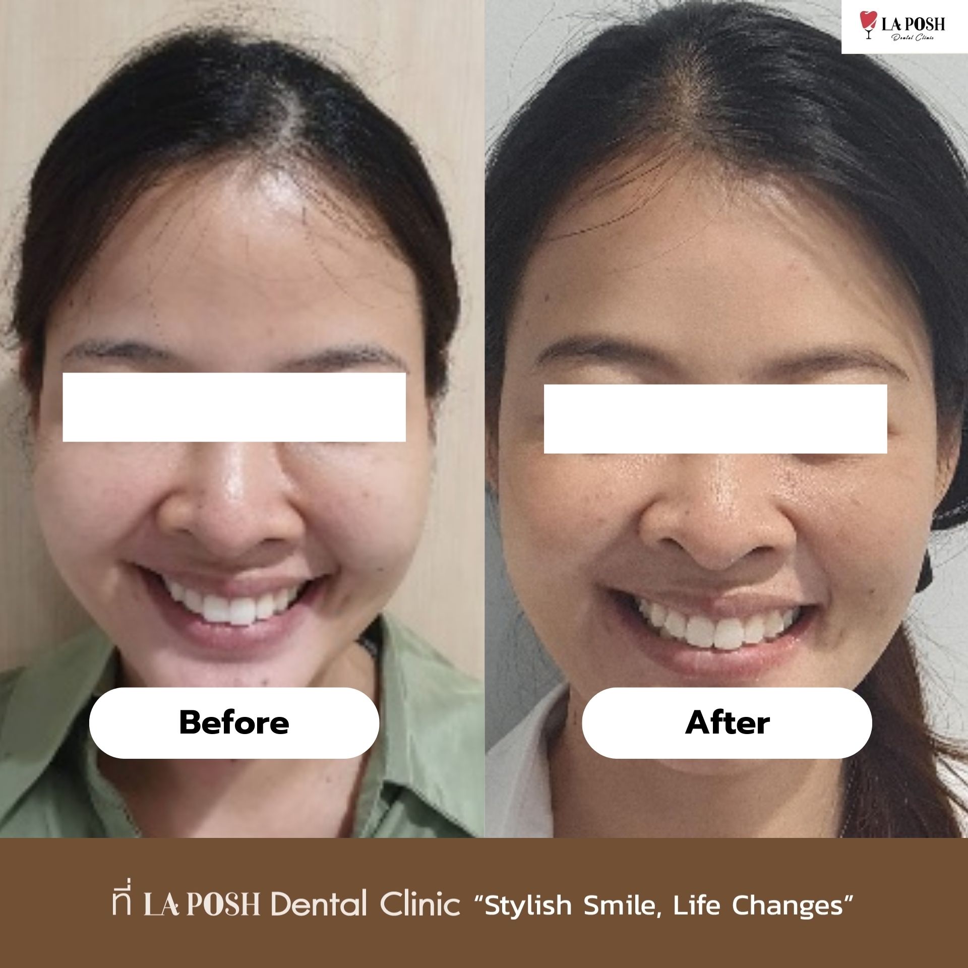 Before - After
