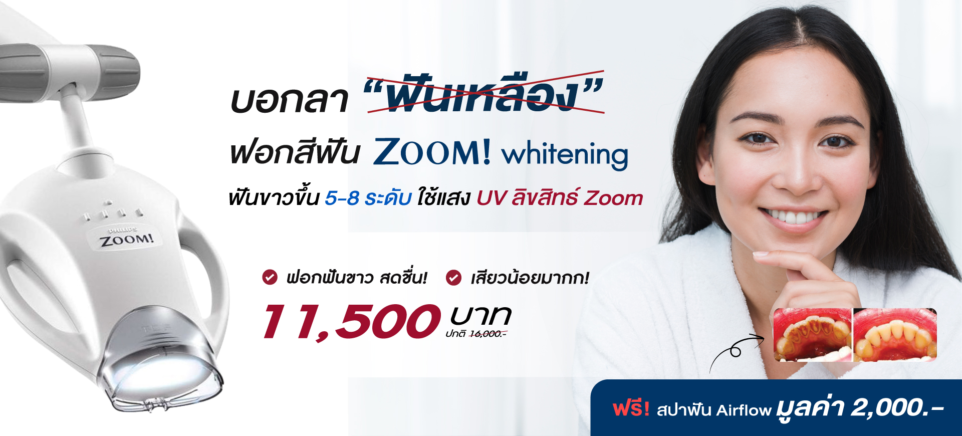 ฟอกสีฟัน zoom whitening