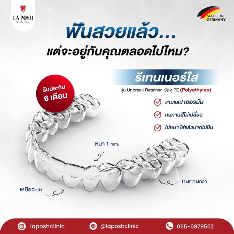 home 21 รีเทนเนอร์ใส Unbreak Retainer งานแล็บเยอรมัน – La Posh Dental Clinic