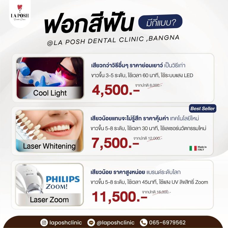 home 25 ฟอกสีฟัน 3 แบบ Cool Light 4,500 / Laser Whitening 7,500 / Zoom 11,500 บาท – La Posh Dental Clinic