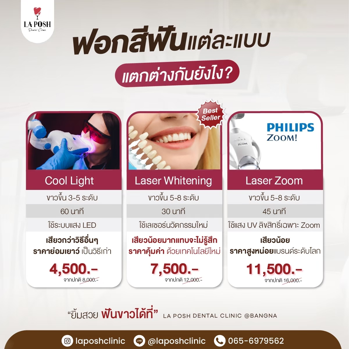 ฟอกสีฟัน ต่างกันยังไง