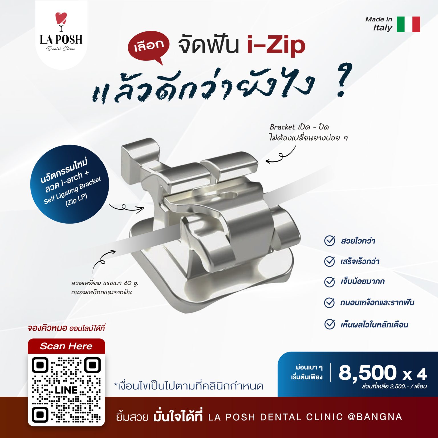 จัดฟัน i arch 1 AW-i-Zip-4