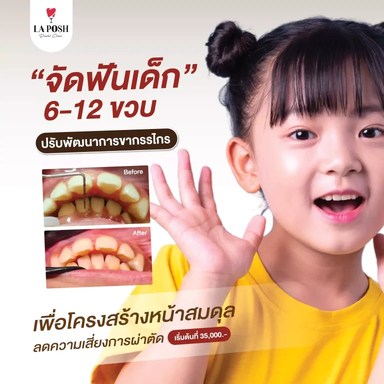 home 29 โปรโมชั่นจัดฟันเด็ก 6–12 ปี ปรับพัฒนาการขากรรไกร เริ่มต้น 35,000 บาท – La Posh Dental Clinic