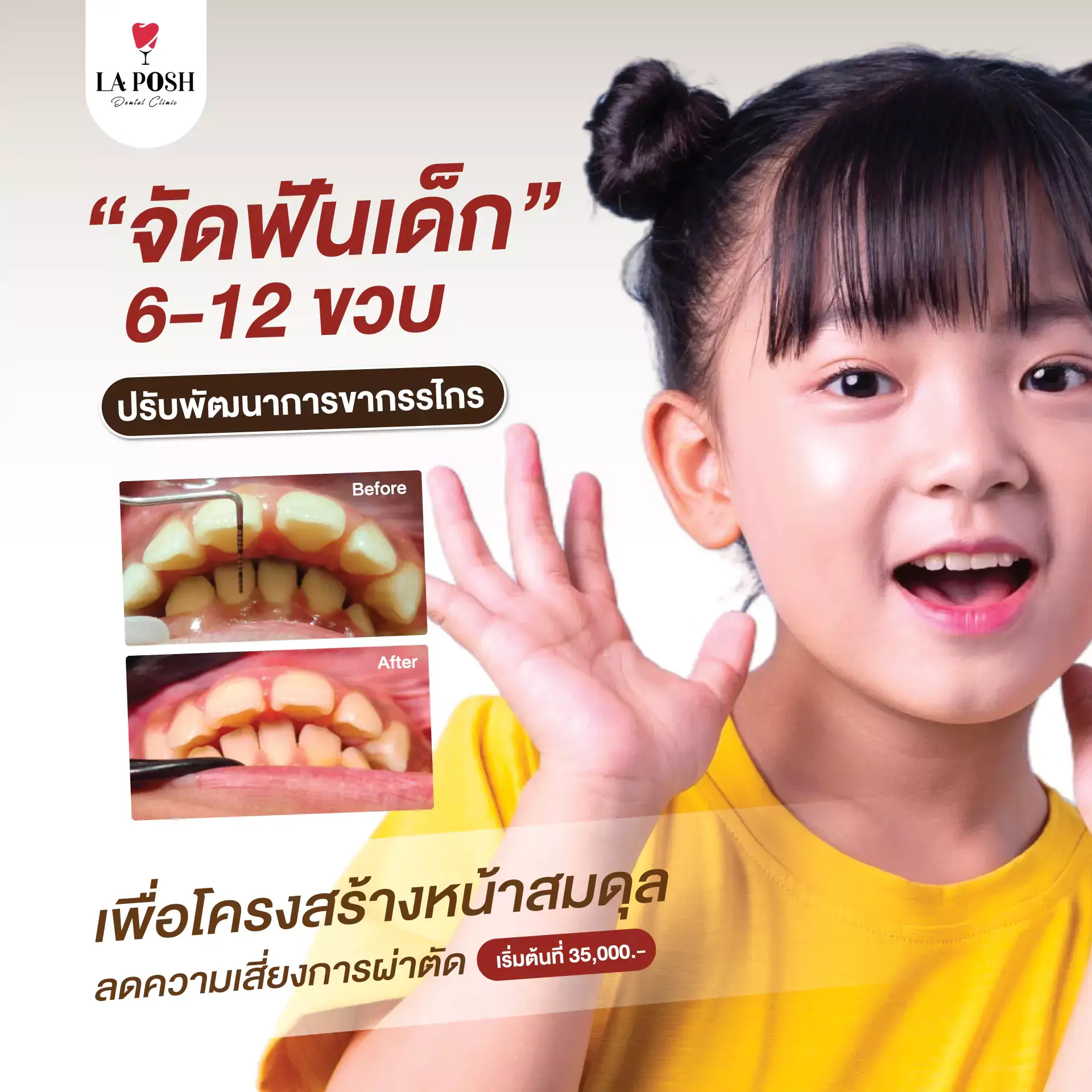 จัดฟันเด็ก