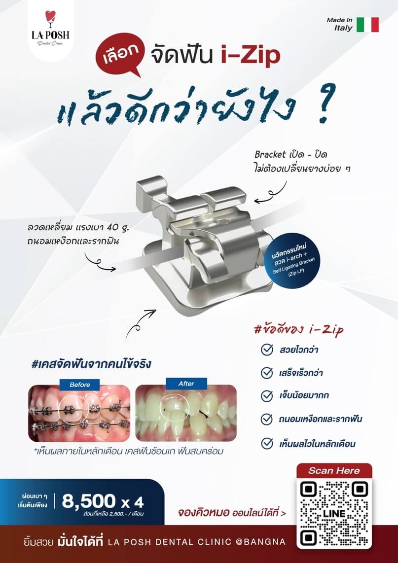 จัดฟัน i-zip