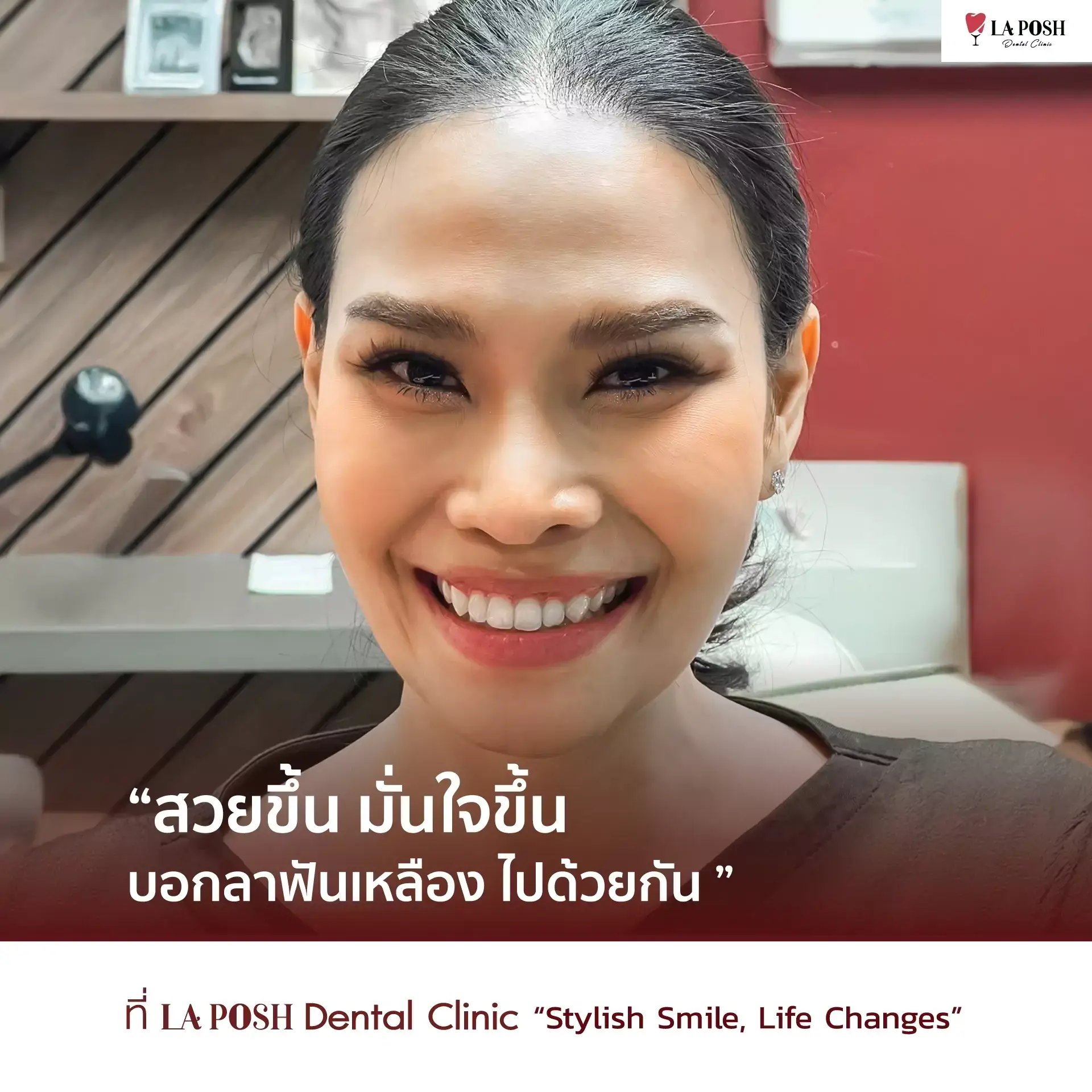 บอกลาฟันเหลืองด้วยการฟอกสีฟัน
