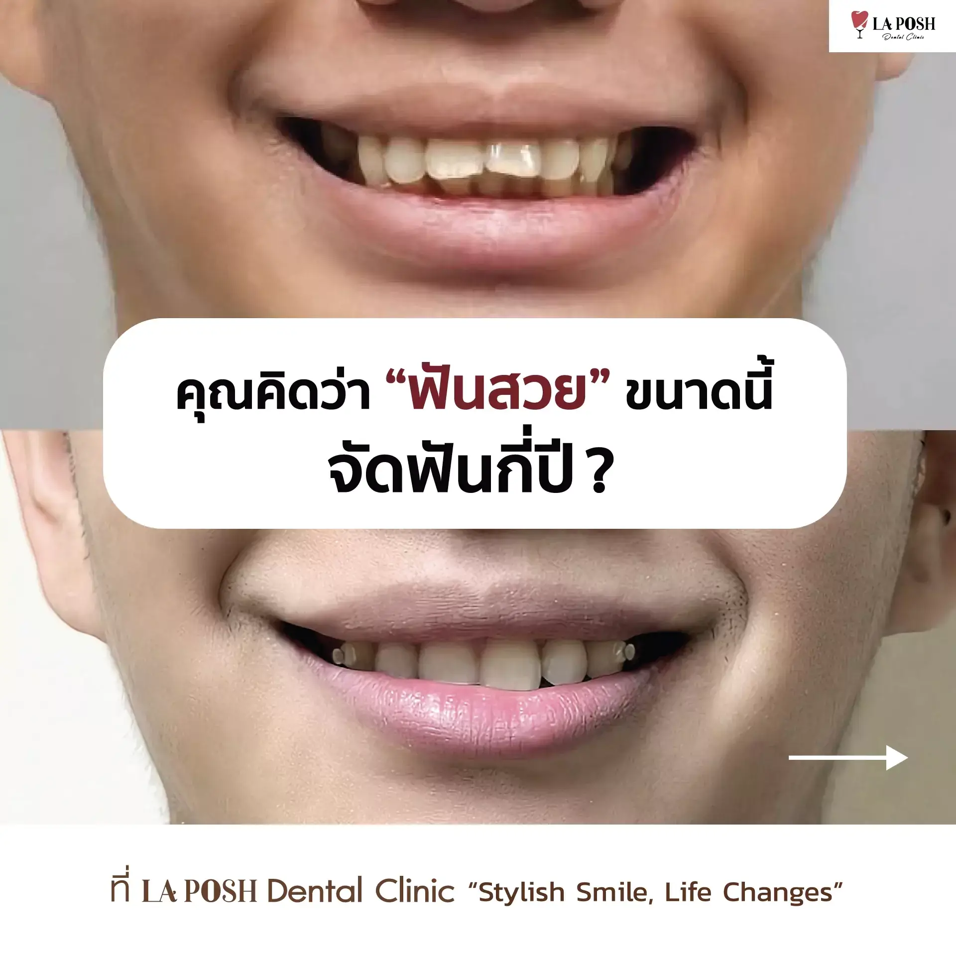 laposhclinic