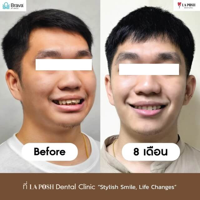 รีวิว