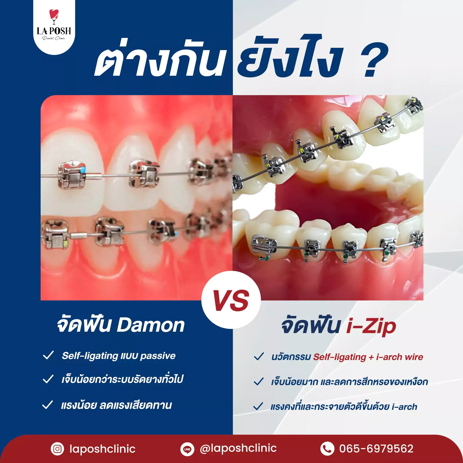 ต่างกันยังไง