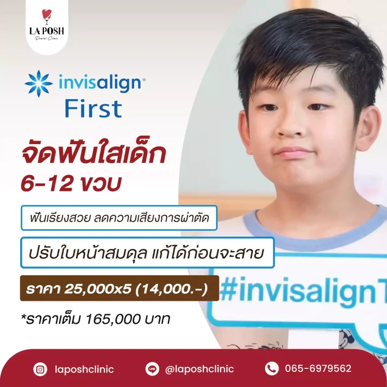home 23 โปรโมชั่นจัดฟันใสเด็ก Invisalign First สำหรับเด็ก 6–12 ปี – La Posh Dental Clinic