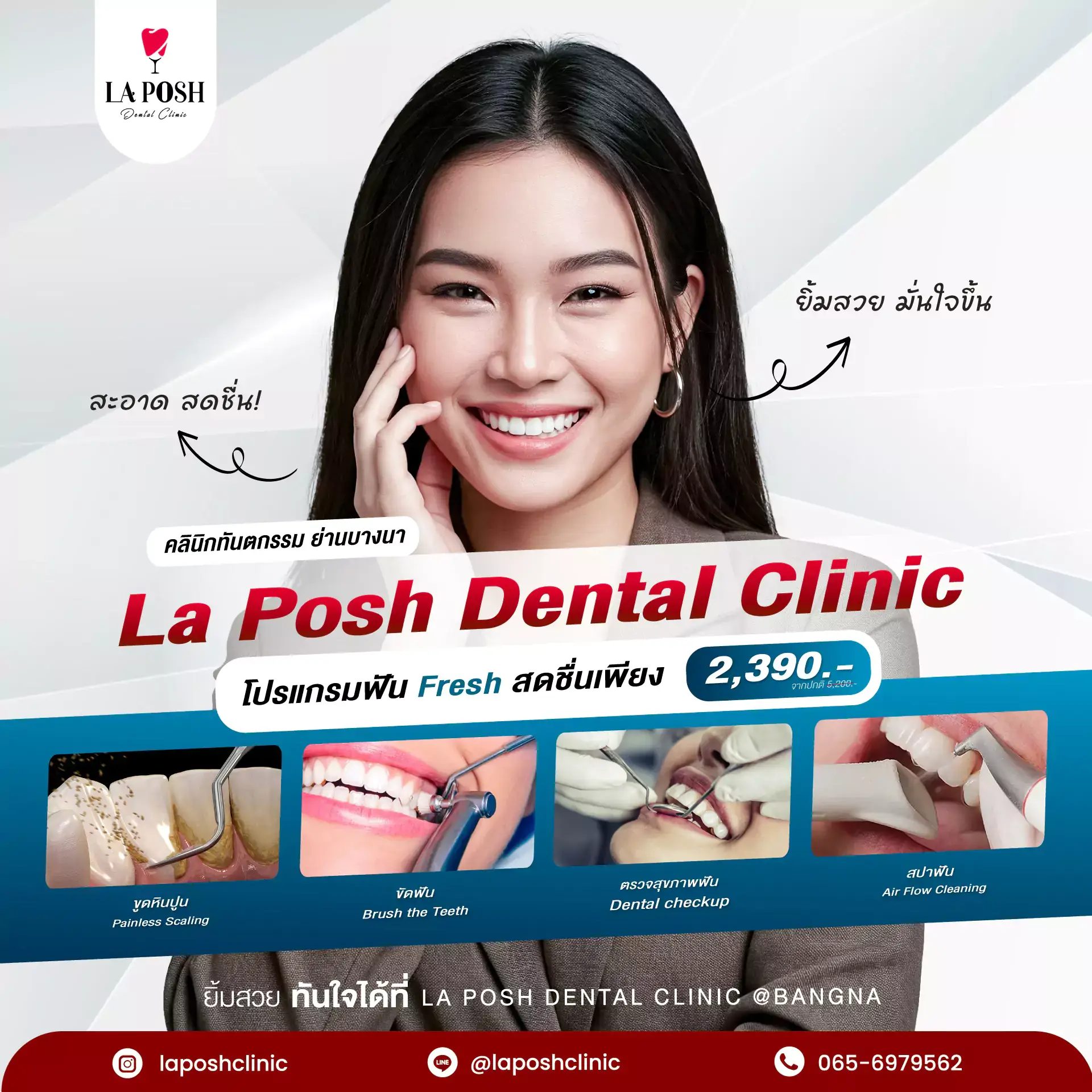 ฟอกสีฟัน laser la posh dental clinic