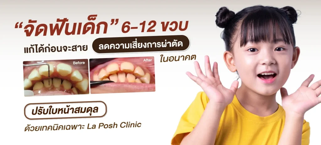 home 8 จัดฟันเด็ก 6–12 ปี ปรับใบหน้าให้สมดุล – La Posh Dental Clinic