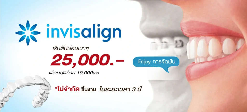 home 9 จัดฟันใส Invisalign ผ่อนเริ่มต้น 25,000 บาท – La Posh Dental Clinic