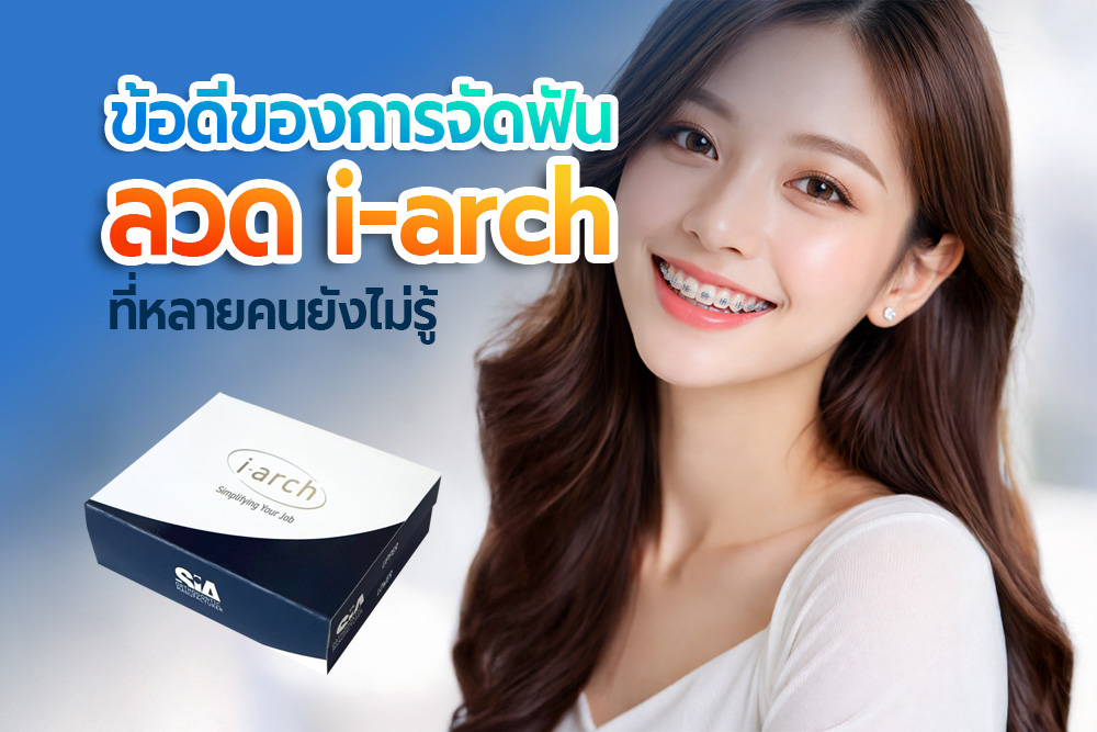 ข้อดีของการจัดฟันลวด i-arch ที่หลายคนยังไม่รู้ 1 Dental ข้อดีลวดI arch 1
