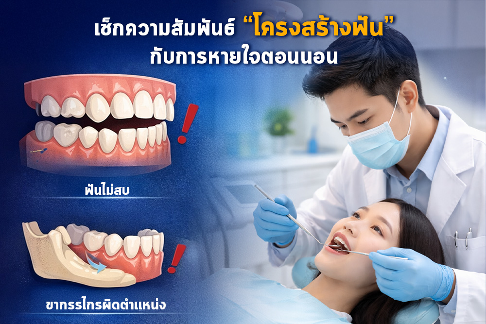 นอนกรนเพราะฟัน? เช็กความสัมพันธ์ “โครงสร้างฟัน” กับการหายใจตอนนอน 1 นอนกรนเพราะฟัน