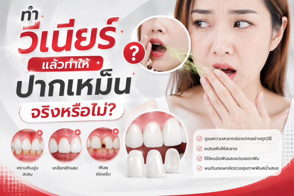 ทำวีเนียร์แล้วทำให้ปากเหม็น จริงหรือไม่? สาเหตุกลิ่นปากหลังทำวีเนียร์และวิธีแก้ 1 ทำวีเนียร์แล้วทำให้ปากเหม็น