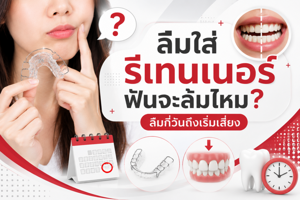ลืมใส่รีเทนเนอร์ ฟันจะล้มไหม? ลืมกี่วันถึงเริ่มเสี่ยง และควรทำอย่างไร 1 Dental laposh ลืมใส่รีเทนเนอร์ 1